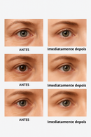 Creme para os Olhos Peter Thomson – Resultados Visíveis Já na Primeira Aplicação!